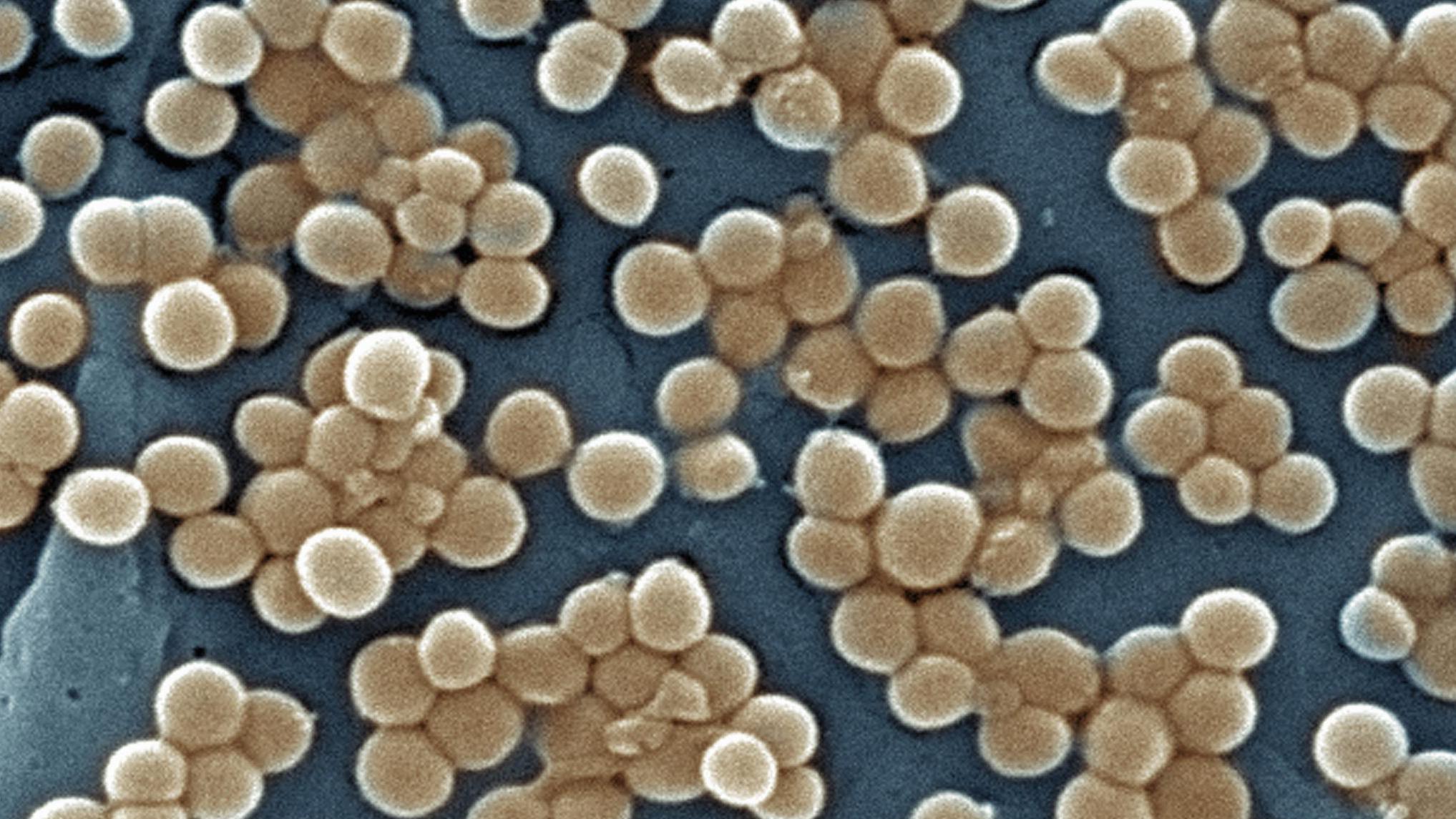 Estafilococo resistente a meticilina  