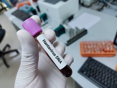 Todo lo que necesitas saber sobre el hantavirus: transmisión, riesgos y prevención en 10 preguntas clave.