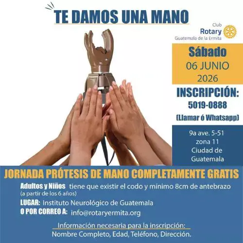 Jornada prótesis manos gratuita en Ciudad de Guatemala